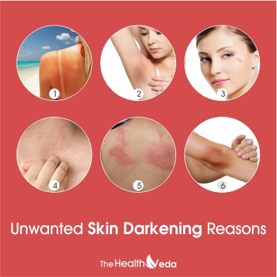 Unwanted-skin-darkening
