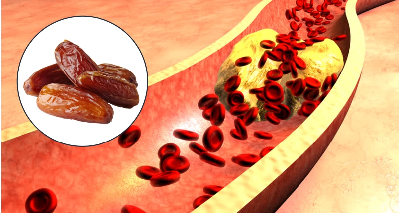 Eating-Dates-can-Help-Regulate-Cholesterol