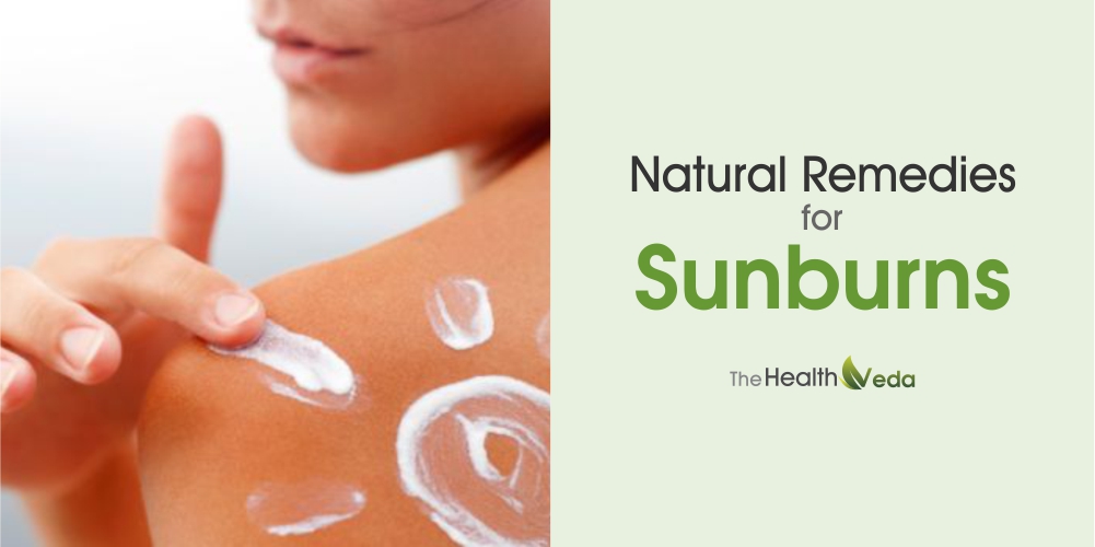 Natural Remedies for Sunburns