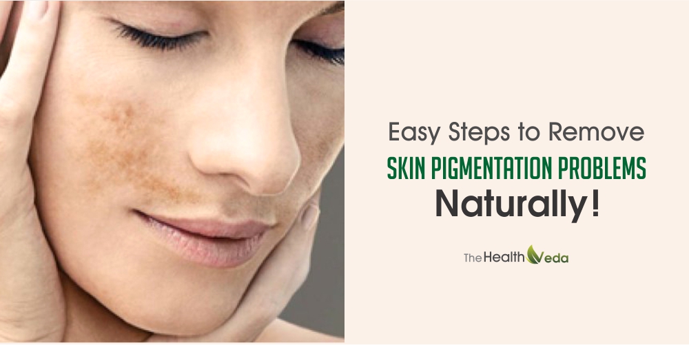 Easy Steps to Remove Skin Pigmentation Problems Naturally!